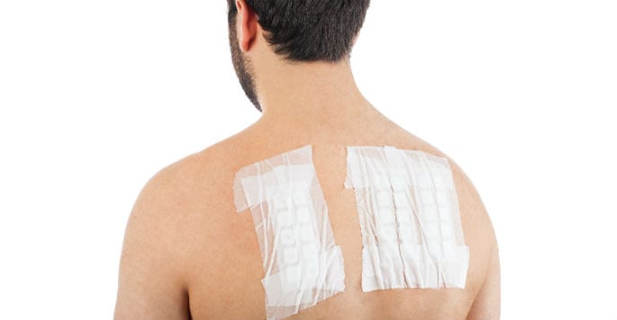 Allergy patch testing