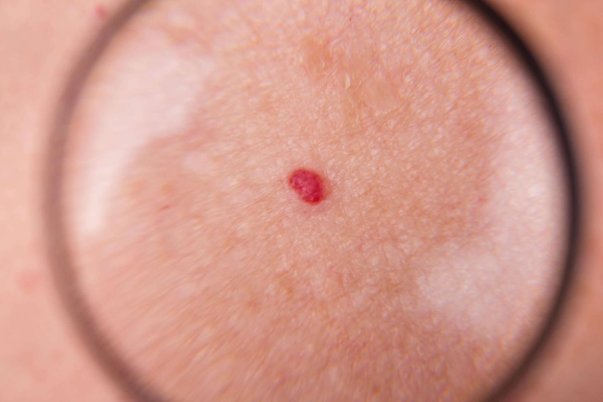 medical-dermatology-rao-dermatology-east-coast